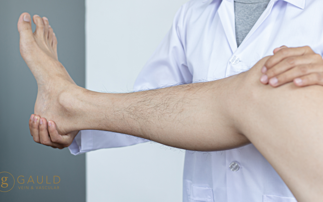 How Soon Can You Return to Normal Activities After Vein Treatment?