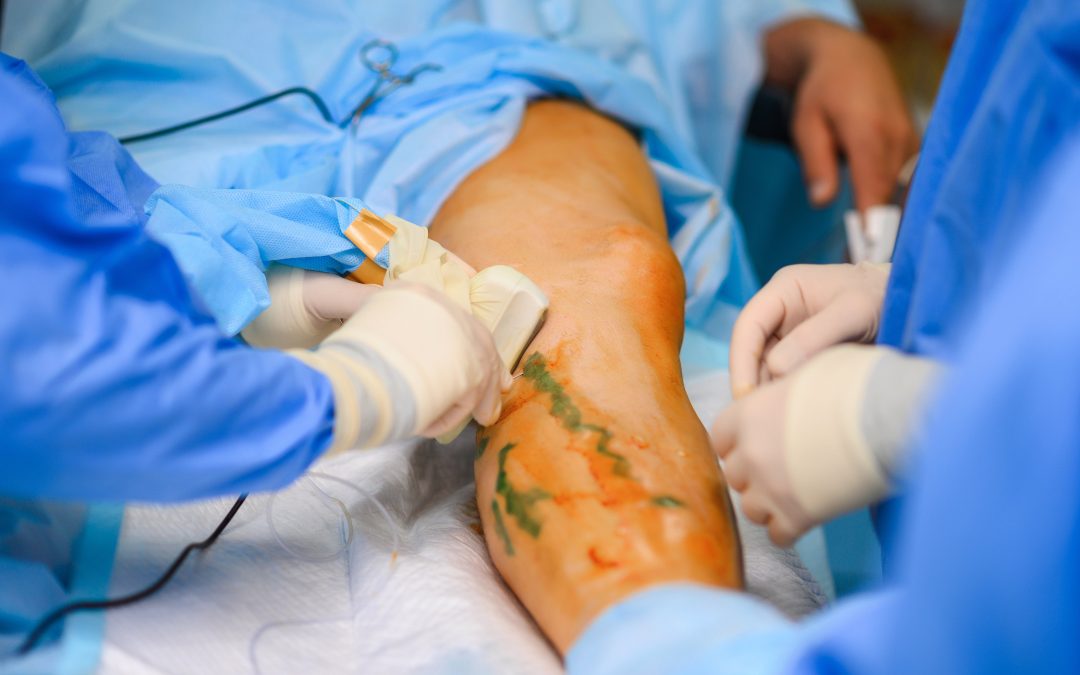 Modern Minimally Invasive Treatments for Varicose Veins