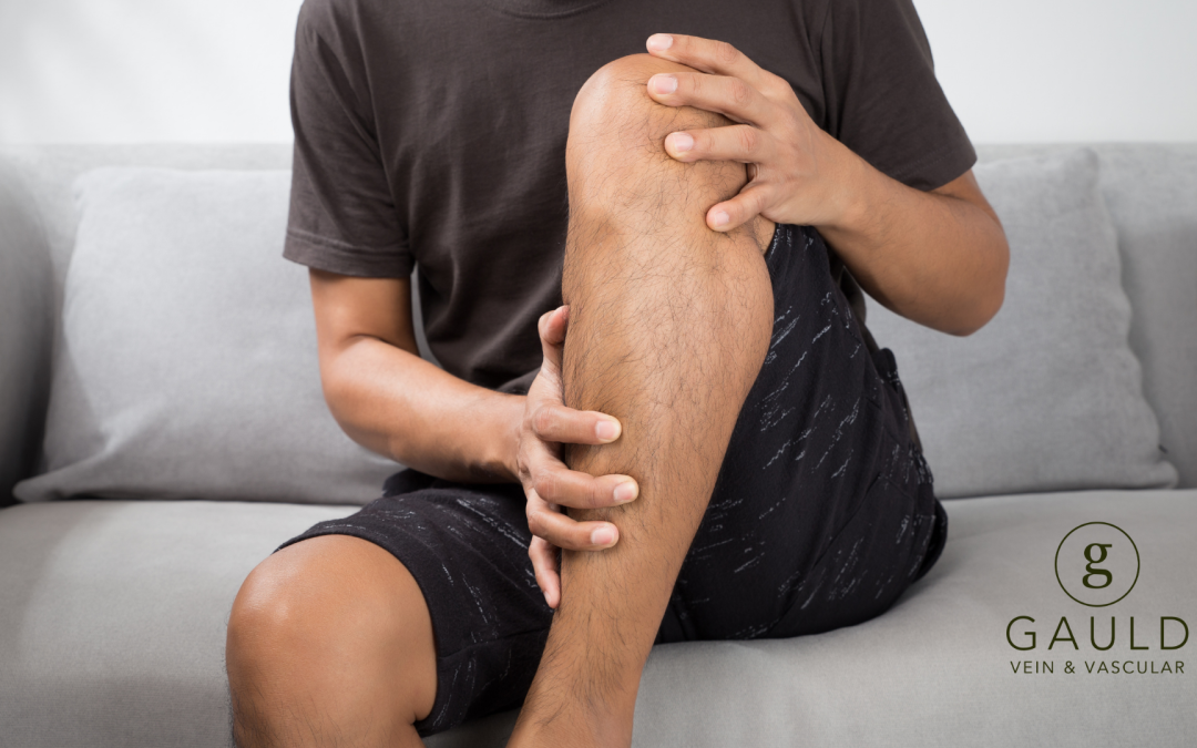 Tips for Managing Bruising and Discomfort After Vein Treatment