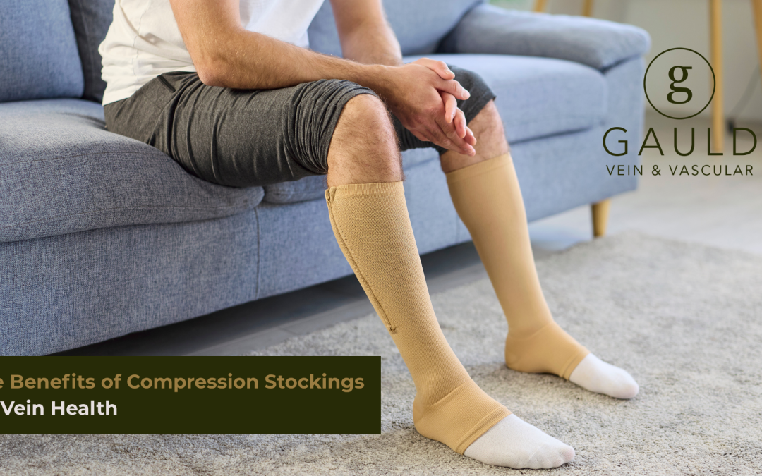 The Benefits of Compression Stockings for Vein Health