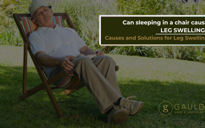 Chair Sleeping: Causes and Solutions for Leg Swelling