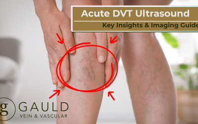 Acute DVT Ultrasound: Key Insights & Imaging Guide