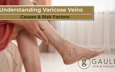 Understanding Varicose Veins Causes & Risk Factors