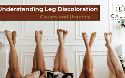 Understanding Leg Discoloration: Causes and Urgency